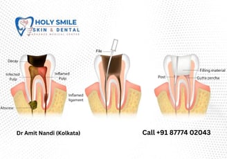 affordable root canal treatment in kolkata