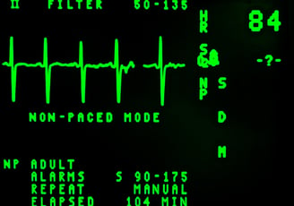 electrocardiograma en morelia