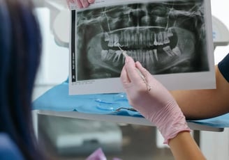 a dentist's hand holding a picture of a patient