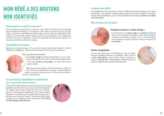 Exemple de chapitre du livre. Reconnaitre les boutons chez mon bébé