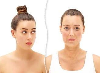 dermal fillers