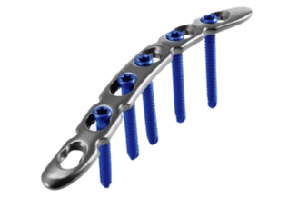 Placa para Clavícula en S