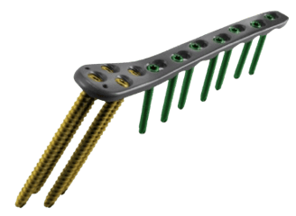 Placa para Fémur Proximal Lateral II