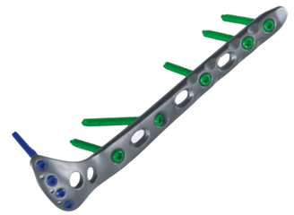 Placa para Tibia Proximal Lateral