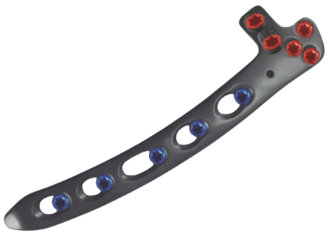 Placa para Húmero Distal Lateral con Soporte