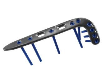 Placa para Tibia Distal Lateral