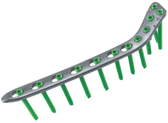 Placa para Tibia Proximal Lateral (Placa Palo de Golf)