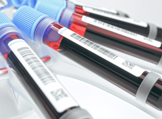 a group of blood test tubes with blood samples