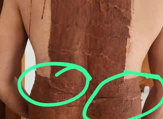 Kerala Ayur Shakti Back Ache Treatment