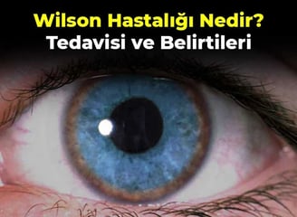 Vücuttaki bakır seviyelerini ölçerek Wilson hastalığı ve diğer sağlık durumlarını değerlendirmeye yardımcı olur.