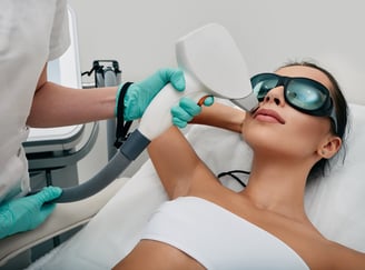laser hair removal
