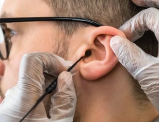 a man having earwax removed with a Jobson Horne probe