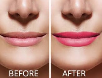 Skindent's Rejuvenate Lip Micropigmentation Services