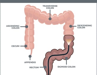 GASTRO FOUNDATION colonoscopy
