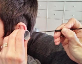 A client having ear wax removal with curettage 