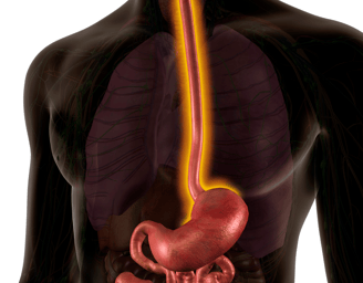 Esophagus cancer treatment in Ahmedabad