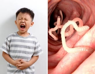 intestinal worms