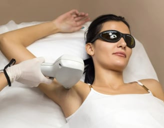 A woman wearing protective sunglasses is getting a laser for under arm hairs.