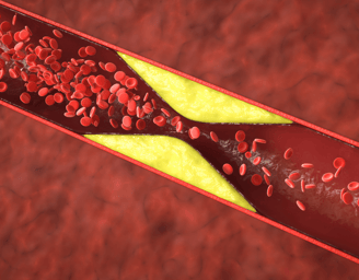 a plaque with red blood cells and blood vessels