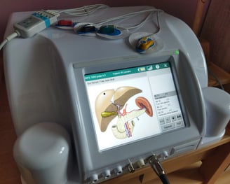 Rayonex Polar et organes
