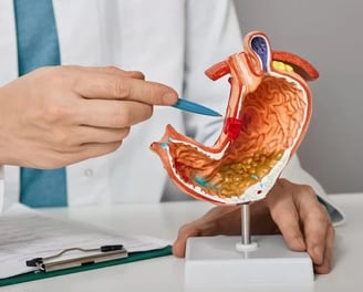 Exames de endoscopia e colonoscopia em Francisco Beltrão