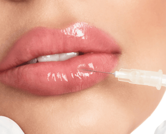 a woman is getting her lips brushed with a needle - tipped needle