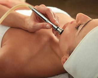Anwendung von Microdermabrasion an einer Frau