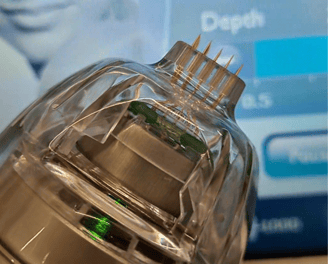 Radiofrequência Microagulhada Robótica (Endymed PRO)