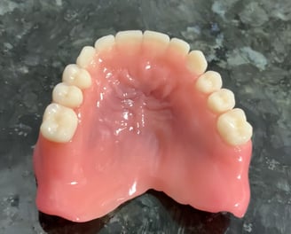 Procad Henares, dentadura completa terminada, maximo realismo técnica SEMC