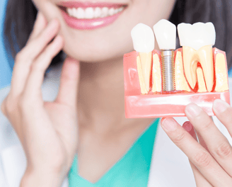 Affordable Dental Implants in Navi Mumbai | Ekdantam Dental Clinic kopar khairane