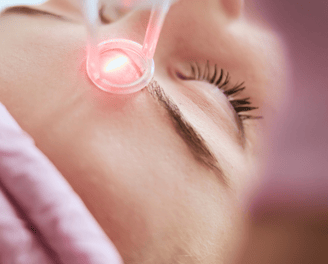 Laser Nd Yag Q-Switched - Dermatologista