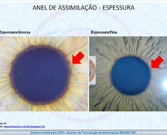 Orla pupilar Interna - OPI - Irismacro Iridologia