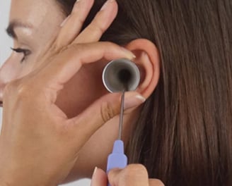 a woman having earwax removed with Microsuction