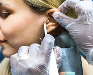 a woman having earwax removed with Water Irrigation