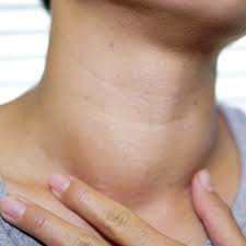 Thyroid