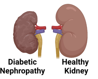 diabetic kidney disease