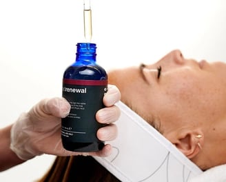 Pipette einer Flüssigkeit zur Fruchtsäurebehandlung