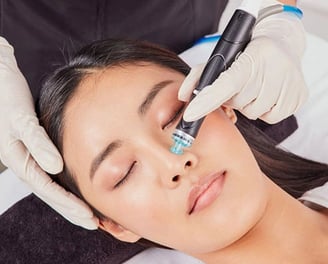 HydraFacial Behandlung an einer Frau