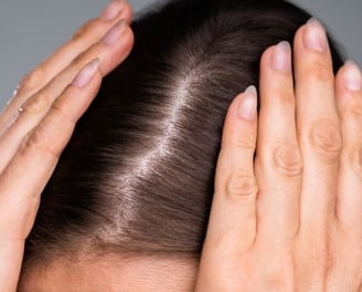 a woman with her hands on her head