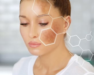 woman with dark spots on her face