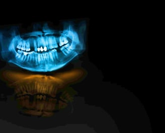 panoramic x-ray