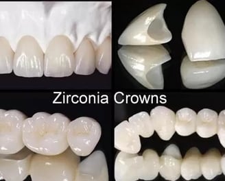 a series of dental crowns with teeth and teeth