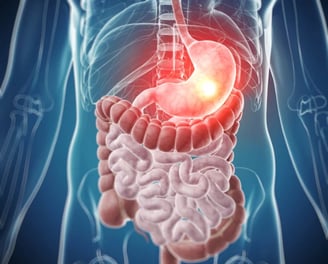 Gastrointestinal cancer