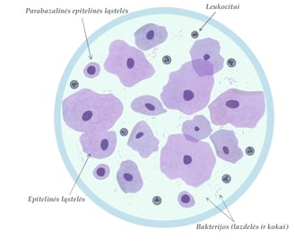 Aerobinio vaginito mikroskopija
