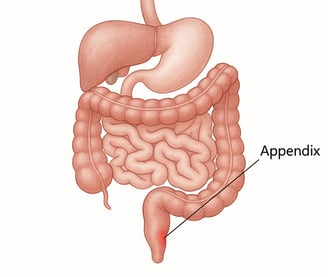 Medical illustration of the human digestive system highlighting the appendix in red, located in the 