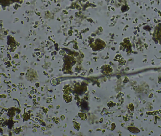 Soil Microbes under the microscope