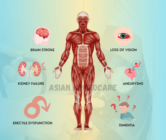 Complications of Hypertension