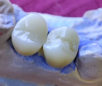 a toothbrush with a toothbrush and toothbrushes