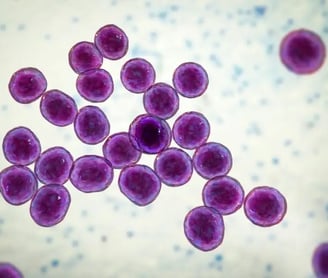 AI discovers new class of antibiotics to kill drug-resistant bacteria