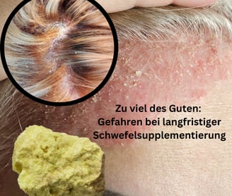 Schuppen bei langfristiger Schwefelsupplementierung